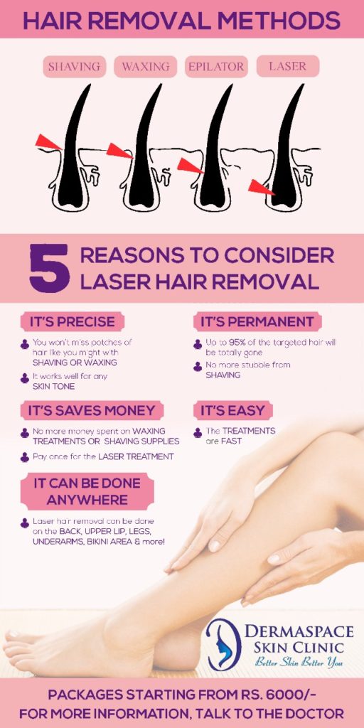 Laser Hair Reduction: Myths and Facts - Dermaspace Laser Hair Reduction: Myths and Facts - Dermaspace